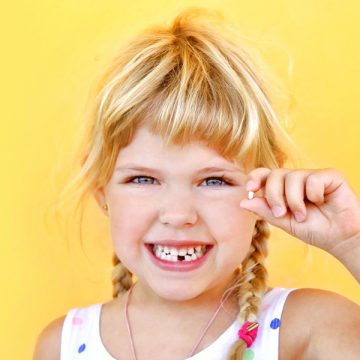 Pediatric Tooth Extractions Are Essential for Teeth Damaged by Injury or Decay