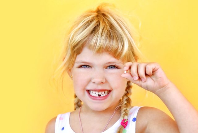 tooth extraction